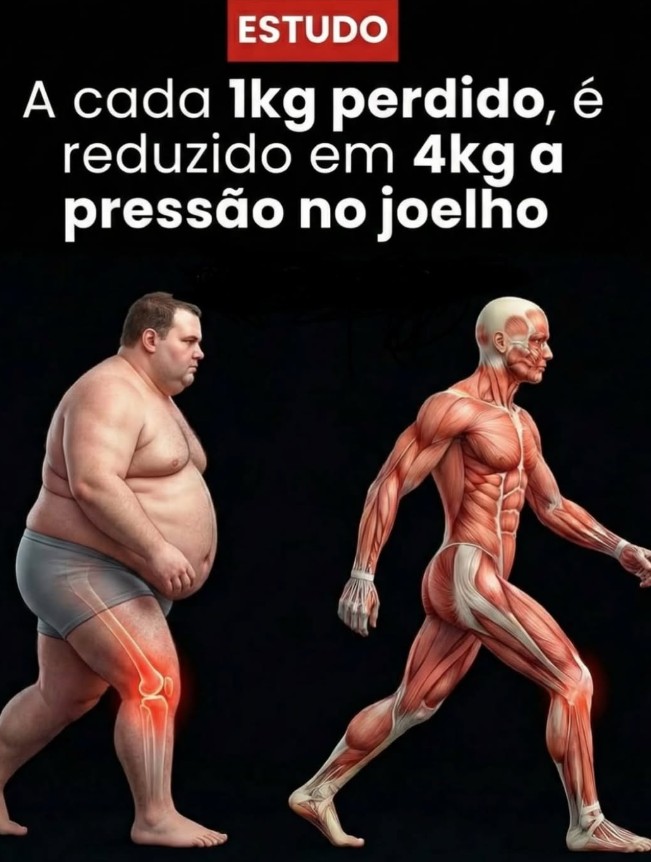 A cada 1kg perdido, reduz 4kg de pressão no joelho